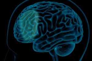 MagVenture’s Accelerator Training Program